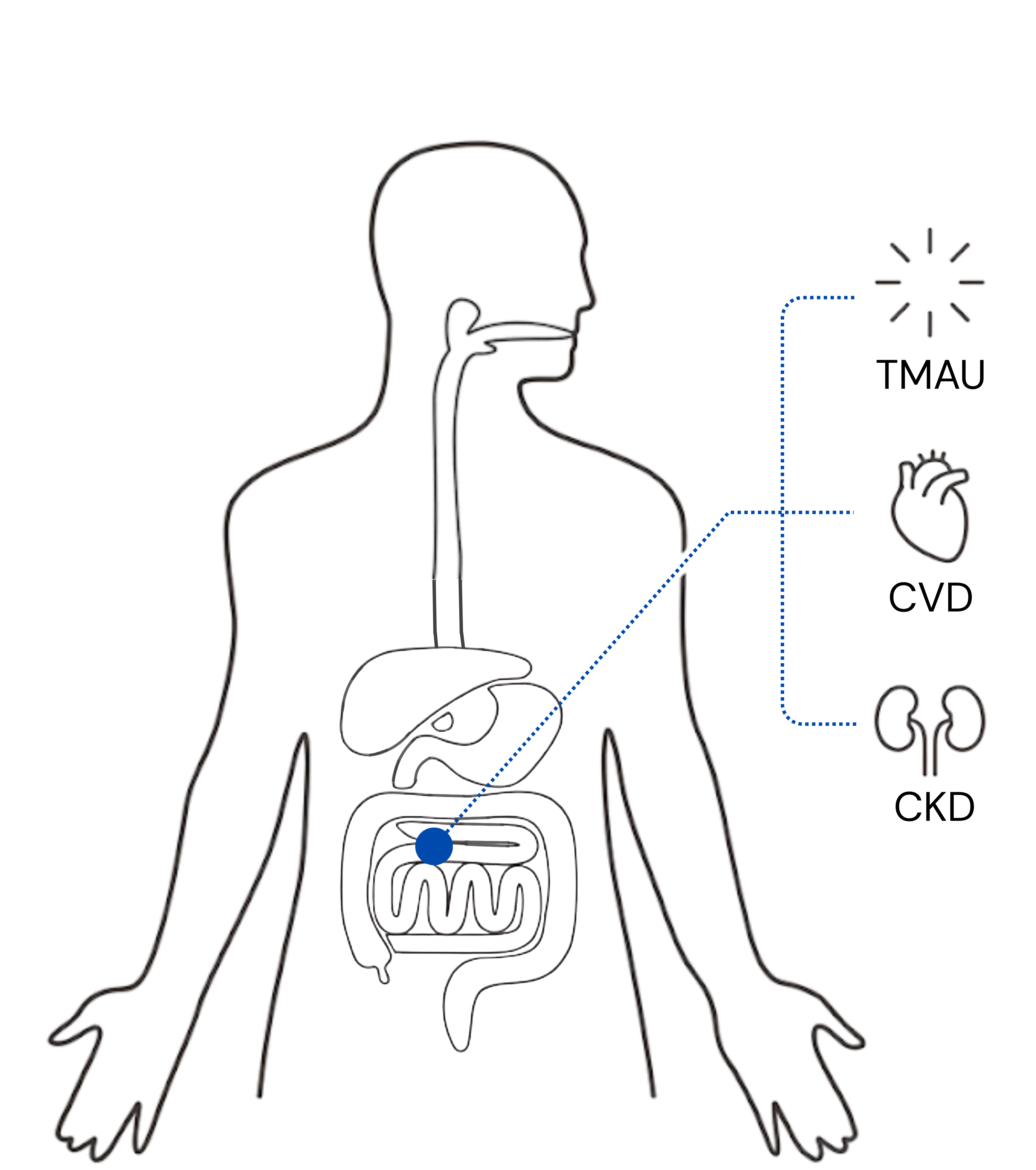 Diagram showing gut-derived metabolites traveling from the gut to the heart, kidneys, and causing TMAU.