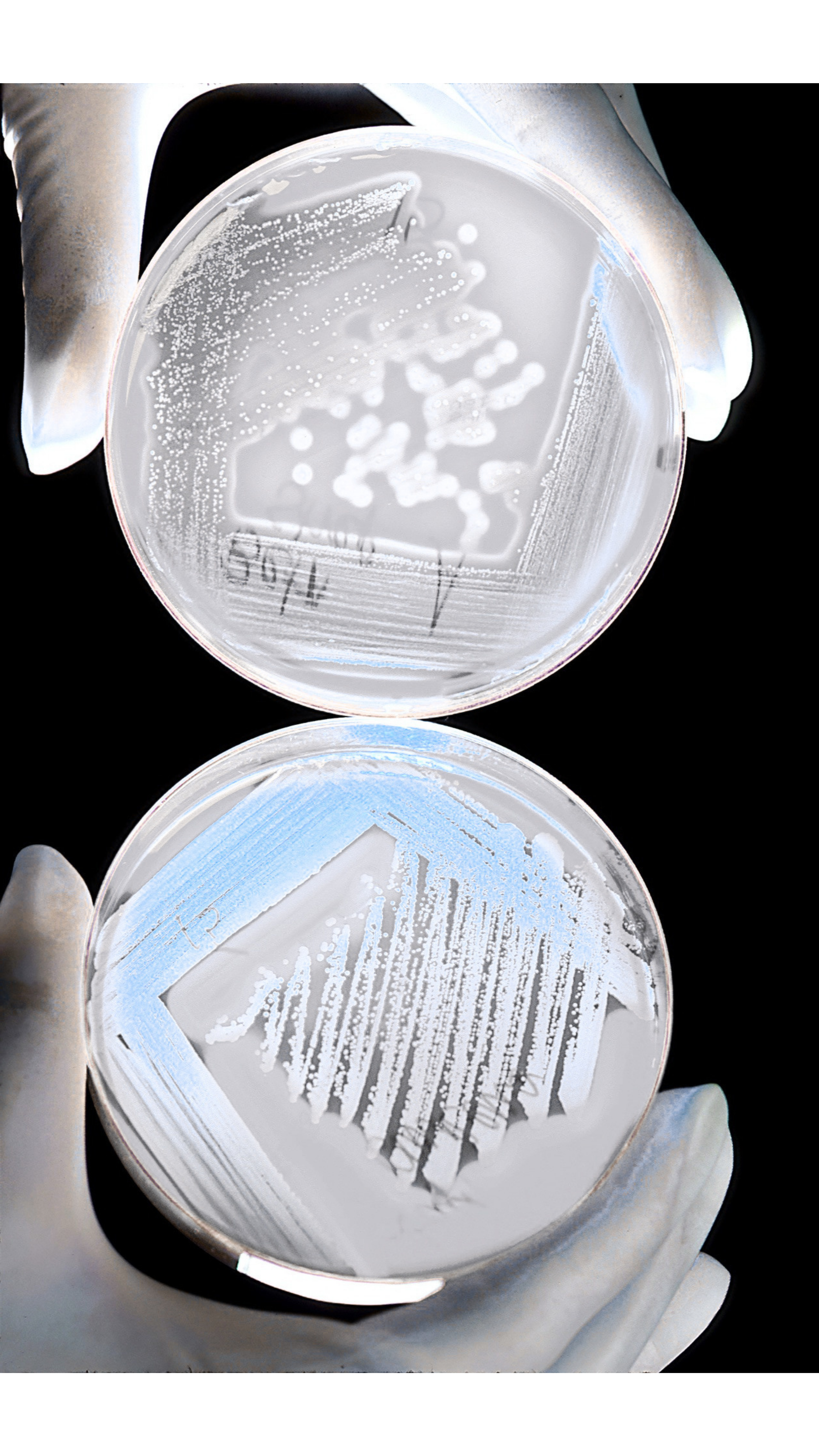 Engineered bacterial culture under microscope
